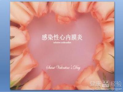 急性感染性心内膜炎 急性感染性心内膜炎