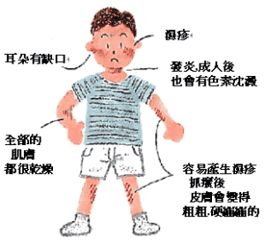 新生儿血小板减少性紫癜 新生儿血小板减少性紫癜