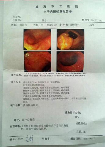 小儿溃疡性结肠炎 小儿溃疡性结肠炎