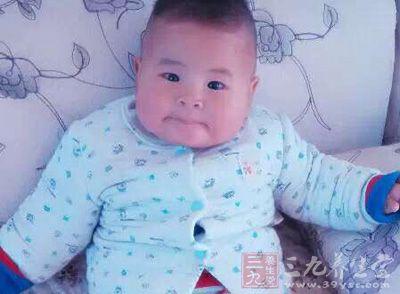 新生儿红细胞增多症-高黏滞度综合征 新生儿红细胞增多症-高黏滞度综合征