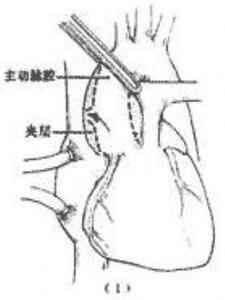 颈部搏动 颈部搏动