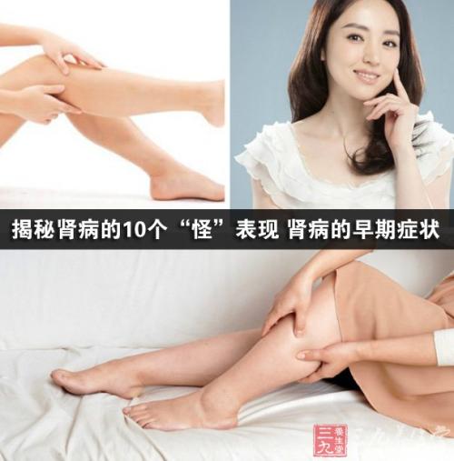身体的低垂部位水肿 身体的低垂部位水肿