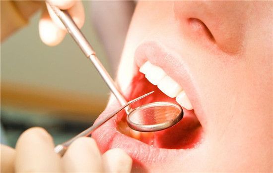 牙结石的形成原因是什么 注意口腔卫生每一天