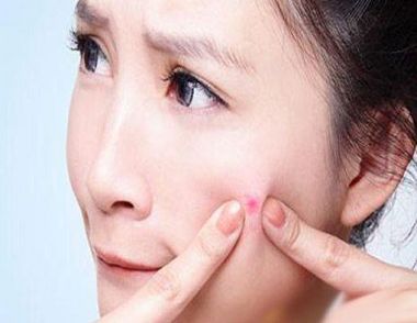 原因是什么 长痘怎么办