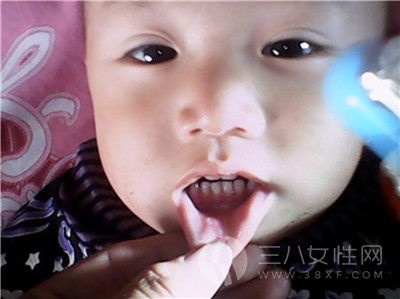 寶寶反複口腔潰瘍是因為什麼1.jpg