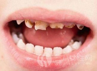 儿童蛀牙会造成哪些危害