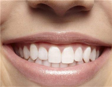 冷光美白牙齒有什麼危害嗎