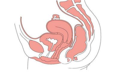 子宫颈肥大是怎么引起的.png