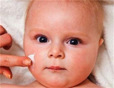 婴儿湿疹该怎么预防和治疗 湿疹吃什么好不能吃什么