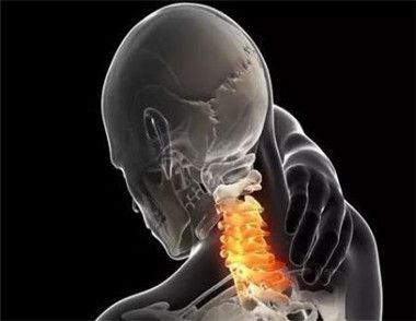 肩頸僵硬該如何進行調理 肩頸問題吃什麼最好