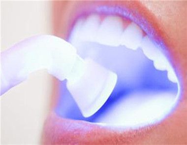 什麼人適合激光美白牙齒 激光美白牙齒和冷光美白牙齒的區別