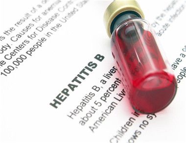 肝炎有哪些明顯的症狀 肝炎病發的原因有哪些