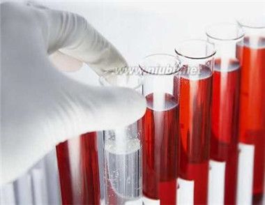 什么是膀胱癌 膀胱癌有哪些症状