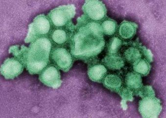 流感病毒悄然转变是怎么回事  流感病毒悄然转变应该如何预防