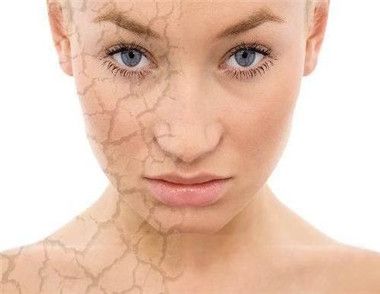 皮膚幹燥是什麼原因 如何針對皮膚幹燥