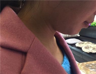 女子结婚时昏迷是怎么回事 什么是婚闹