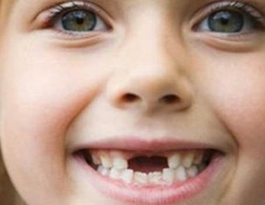 ​儿童换牙的时间是什么 儿童换牙顺序是什么
