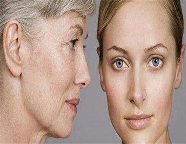 什么是皮肤老化 皮肤老化有哪些原因