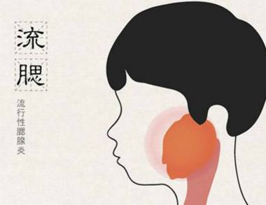 腮腺炎的症状有哪些 腮腺炎是什么原因引起的