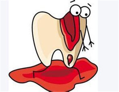 牙齦出血怎麼辦 為什麼會牙齦出血