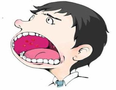 口腔潰瘍是怎麼回事 口腔潰瘍有什麼危害