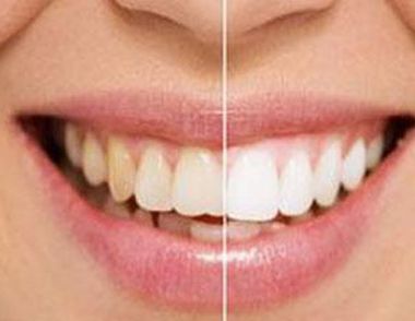 蛀牙的原因是什么 蛀牙要补吗