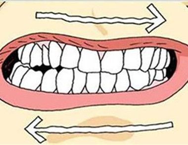 导致睡觉磨牙的原因可能有哪些 磨牙有哪些办法治疗