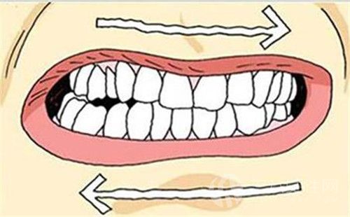 磨牙有哪些办法治疗