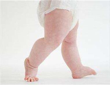 ​寶寶腿型不直怎麼辦 寶寶腿型不直怎麼預防