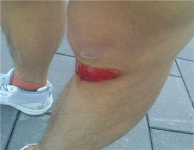 女子在墓园摔伤是怎么回事 女子在墓园摔伤为什么要墓园赔偿