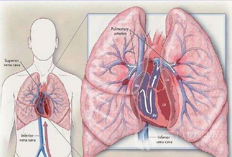 肺栓塞的症状有哪些.png
