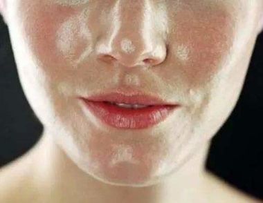 皮肤油腻有哪些原因 皮肤油腻怎么办
