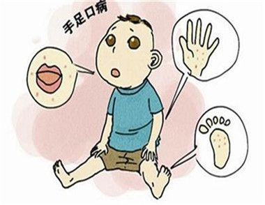 宝宝有手足口病能喝奶吗 宝宝有手足口病吃什么好