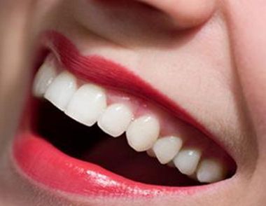 有哪些方法可以使牙齒變白 哪些人不適合做牙齒美白