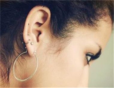 女性打耳洞必须注意哪些事 如何避免耳朵流脓发炎