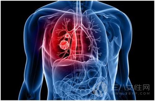 肺癌早期怎么治疗