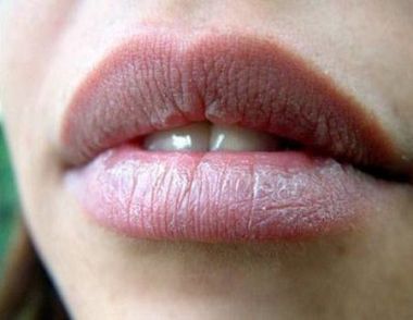嘴唇上長泡是什麼原因 嘴唇長泡怎麼辦