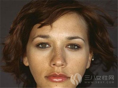 女性臉上為什麼會長斑