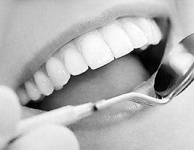 洗牙的誤區 洗牙有哪些認識誤區
