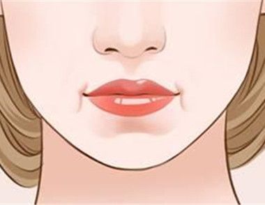 嘴角纹怎么去除 为什么会有嘴角纹