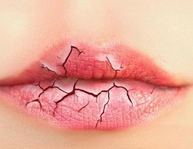 唇紋深是什麼原因 怎麼淡化唇紋