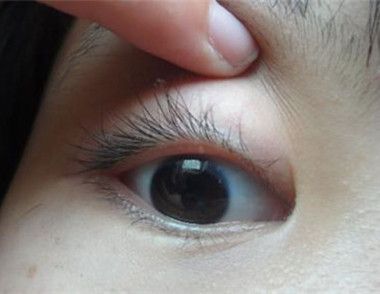 眼瞼上長的小顆粒是什麼 眼瞼上長的小顆粒怎麼去除