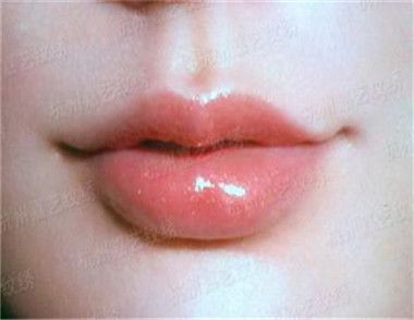 漂唇有什麼危害 漂唇的危害有哪些