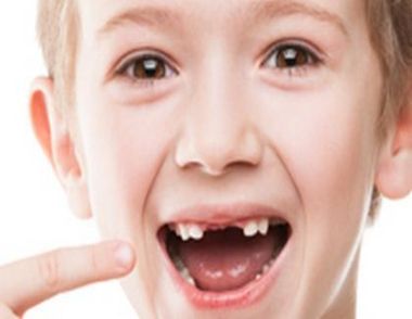 小孩什麼時候開始換牙 小孩換牙要注意什麼