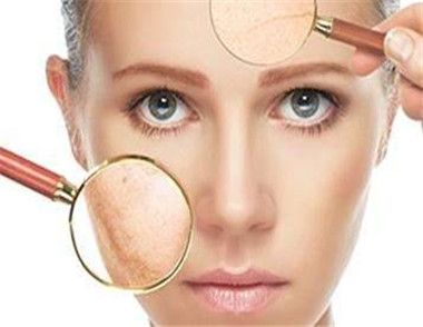 臉部皮膚過敏怎麼辦 搞定臉部皮膚過敏的方法有哪些