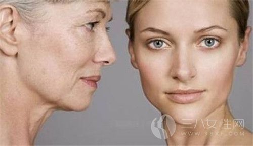 　　女人什么时候开始长老年斑 预防老年斑的方法有哪些1.jpg