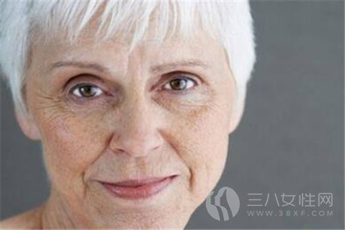 　　女人什么时候开始长老年斑 预防老年斑的方法有哪些.png