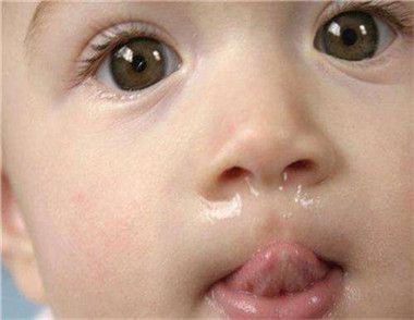 ​宝宝夏天感冒流鼻涕怎么办 宝宝感冒流鼻涕食疗