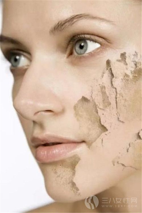 皮肤干燥是什么引起的 皮肤补水正确方式1.jpg