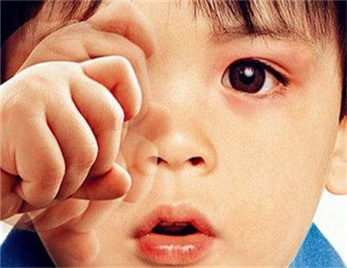 孩子眨眼睛很频繁是什么原因 孩子眨眼睛很频繁怎么办